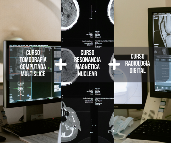Resonancia Magnética Nuclear + Radiología Digital + Tomografía Computada