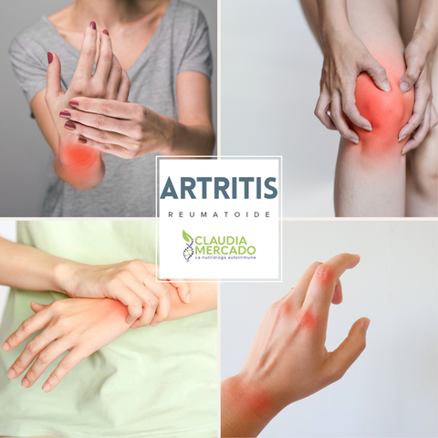 Artritis y los lácteos.