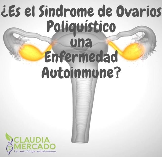 ¿Es el Sindrome de Ovario Poliquístico una Enfermedad Autoinmune?