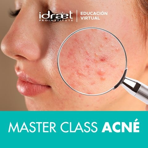 Master Class sobre Acné