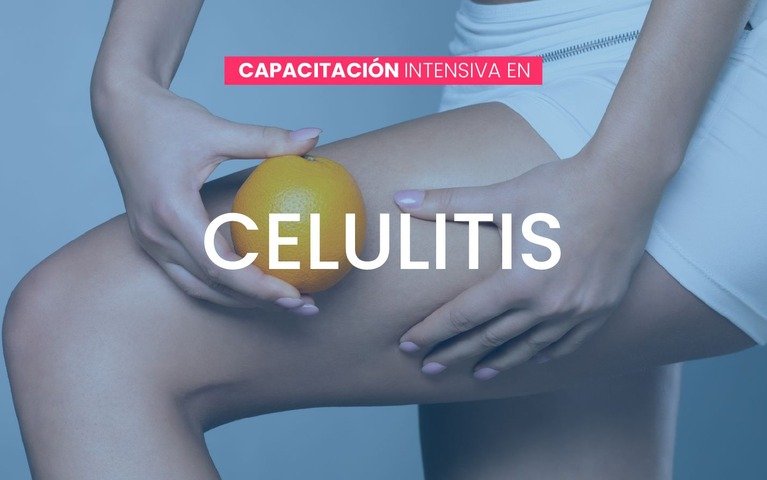 Abordaje Integral de la Celulitis